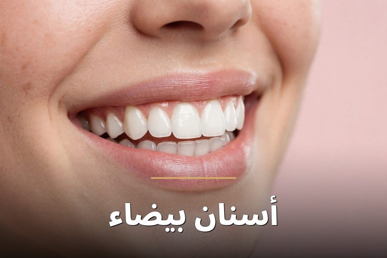 ابتسامة وأسنان بيضاء صحية